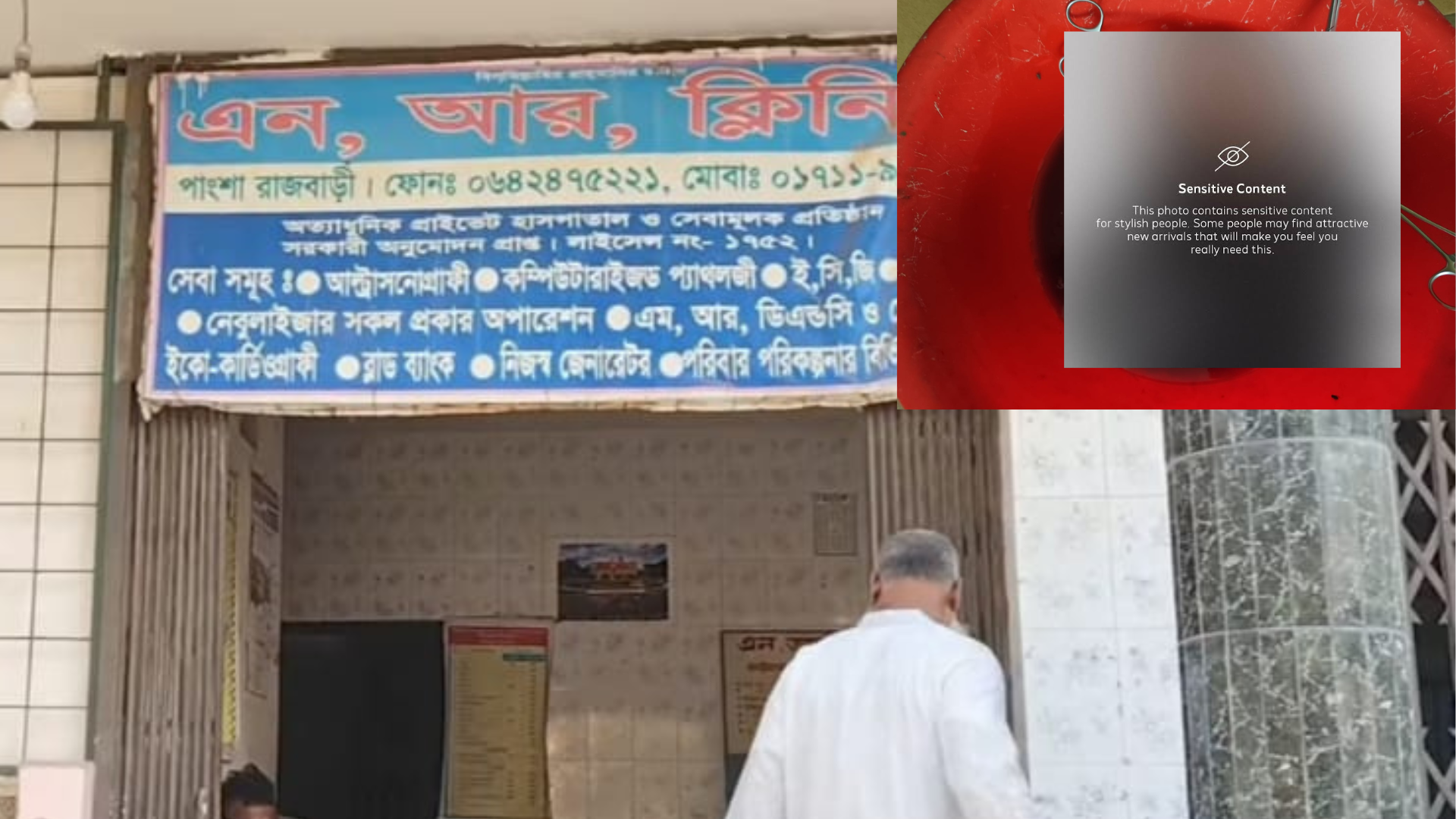 পাংশায় অস্ত্রোপচারে তরুণীর পেট থেকে ১৭ কেজি ওজনের টিউমার অপসারণ