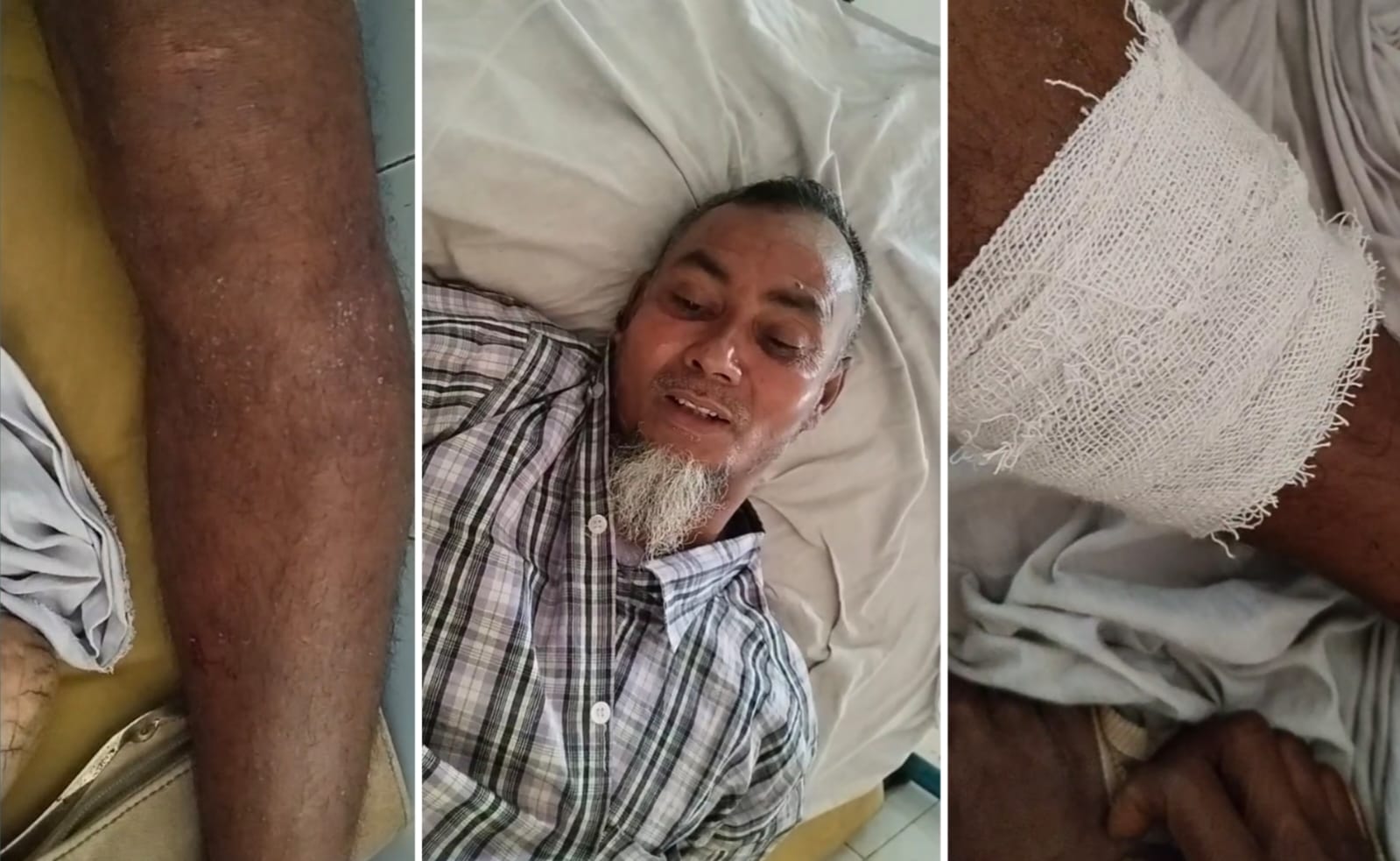 মামলা তুলে নিতে চাপ ও চাঁদা না দেওয়ায় কৃষককে মারধরের অভিযোগ, হাসপাতালে ভর্তি