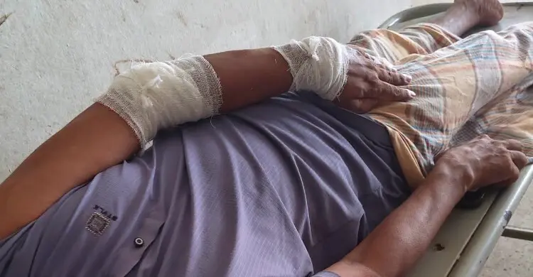 চাঁদা না দেয়ায় পটিয়ায় বিএনপি নেতার ওপর সন্ত্রাসী হামলা