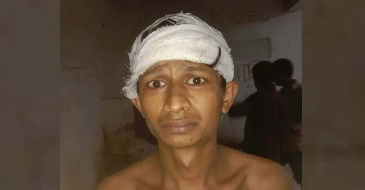 মোহাম্মদপুরে ‘মাদক অভিযানে’ যুবকের মাথা ফাটল, দায় এড়াচ্ছে সবাই